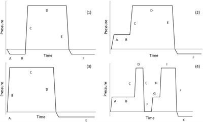 Incising and Double Impregnation of Beech Sleepers—Investigation of an Alternative Preservation System for Wooden Railway Sleepers